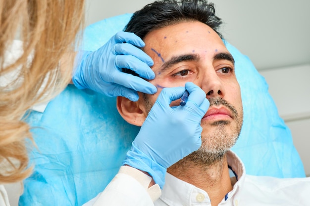 45yearold darkhaired man in an aesthetic clinic with his face painted with strokes for treatment