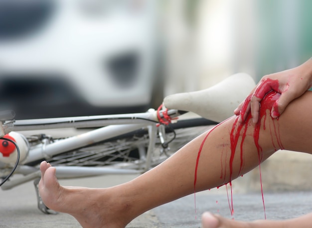 Accident from a bicycle collided with a car