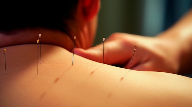 Photo acupuncture back neck spa salon generative ai people