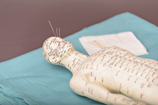 Acupuncture model with needles in the head