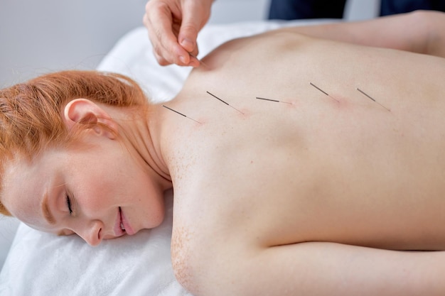 Acupuncturist treats female patient's illness with acupuncture at special points on back spine Acupuncture is alternative medicine healthy treatment concept closeup focus on spinebody