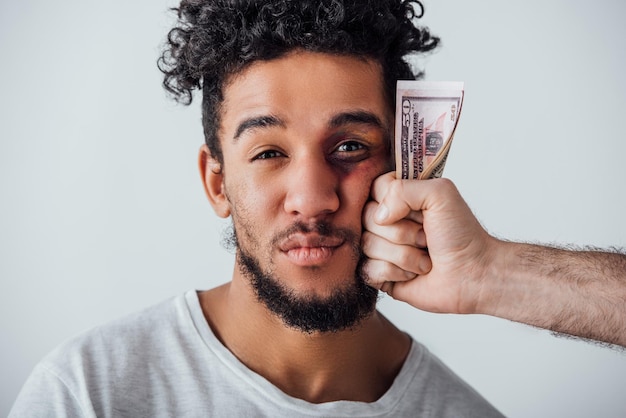 African american man with bruise looking at camera near male hand holding cash isolated on grey