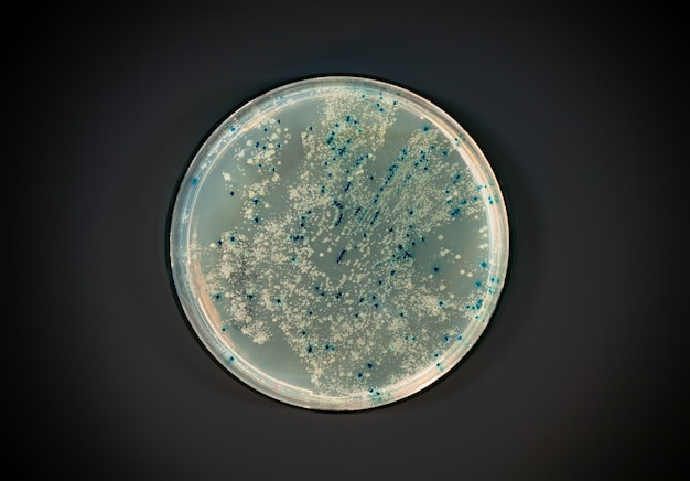 Agar plate with bacterial colonies on dark wall