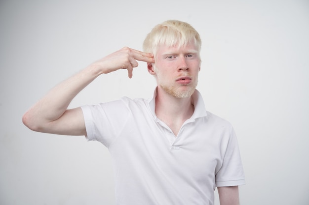 Albinism albino man in studio dressed t-shirt isolated on a white background. abnormal deviations. unusual appearance