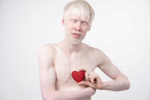 Albinism albino man