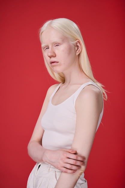 Albino girl with unusual appearance