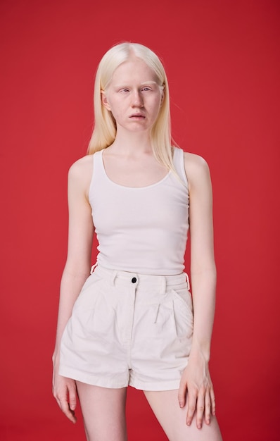 Albino woman with natural beauty