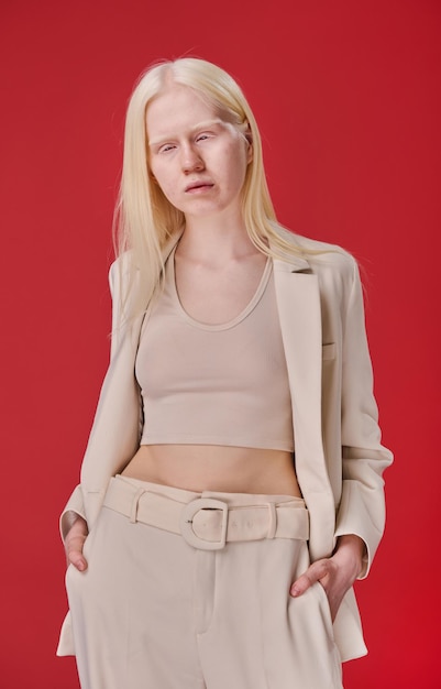 Albino young girl in elegant suit