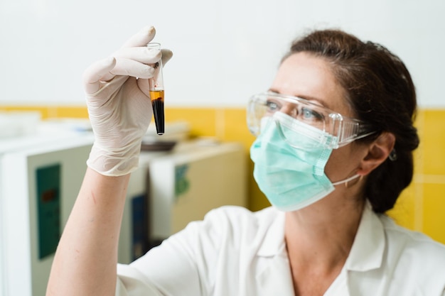 Analysis of blood plasma The laboratory assistant holds a test tube with blood from a vein in his hands and looks at it Blood test in the laboratory Medical scientist with glasses and mask