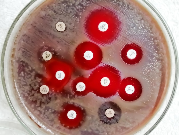 Antimicrobial susceptibility testing in petri dish. Antibiotic resistance of bacteria.