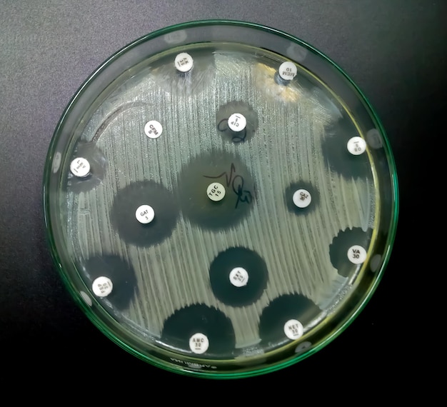 Antimicrobial susceptibility testing in petri dish