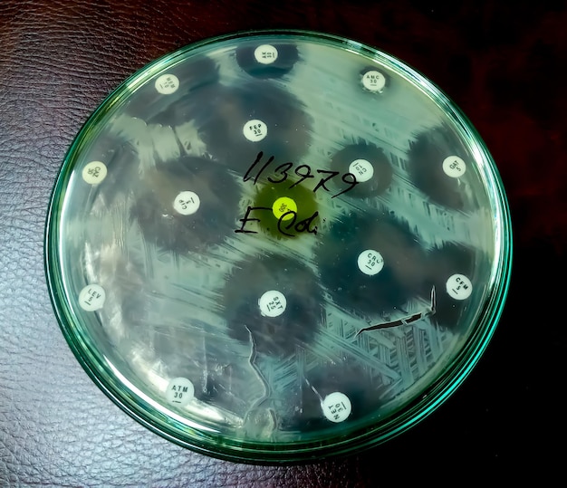 Antimicrobial susceptibility testing in petri dish