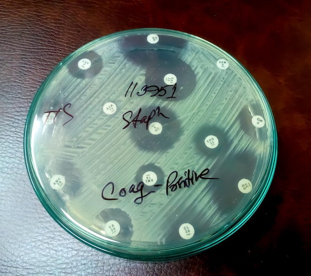 Antimicrobial susceptibility testing in petri dish