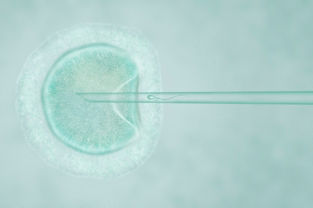 Artificial Insemination by Intracytoplasmic Sperm Injection