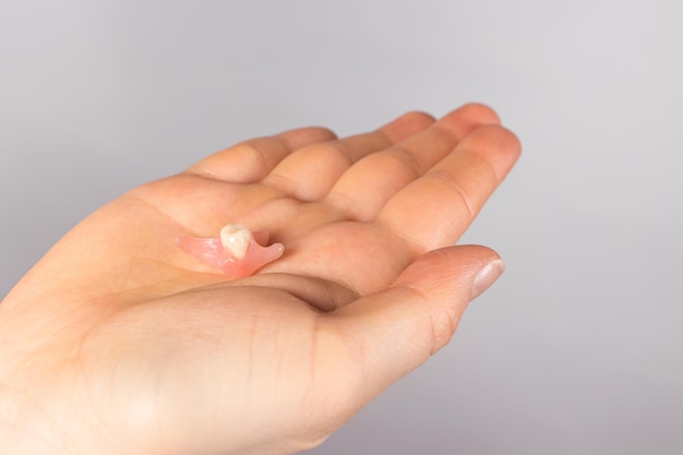 Artificial tooth prosthesis in a person's hand