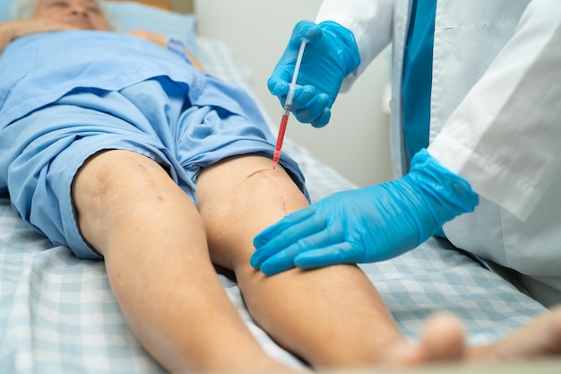 Asian doctor inject Hyaluronic acid platelet rich plasma into the knee