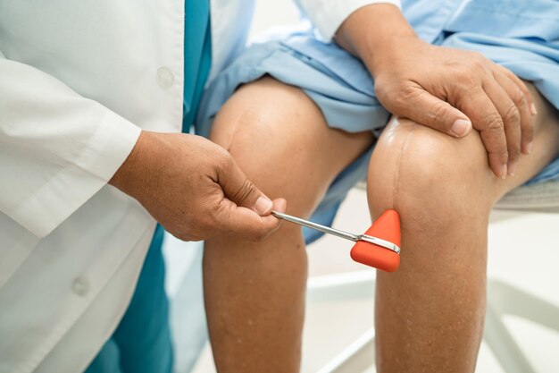 Asian doctor use hammer knock senior woman patient to check knee reflex nerve and muscle in hospital