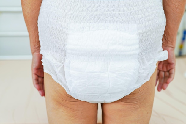 Asian elder senior woman patient wearing adult incontinence diaper pad in hospital