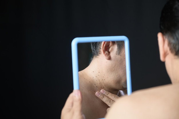 Photo asian middle man looks in the mirror and point to skin tags or acrochordon on neck