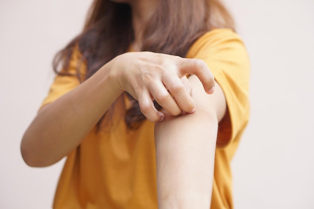 Asian woman having itchy skin on arm