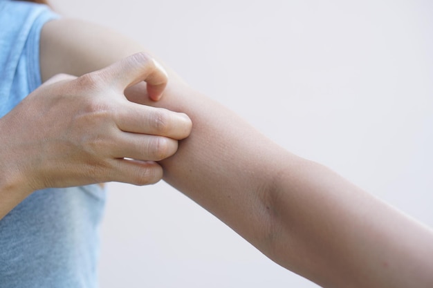 Asian woman having itchy skin on arm