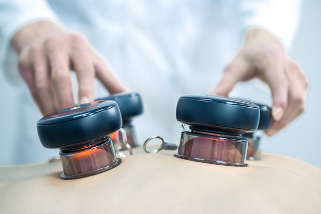 Back treatment Doctor putting medical cups on his patients back