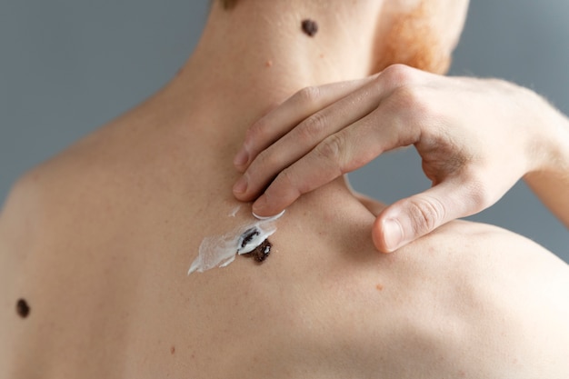 Photo back view man applying cream on mole