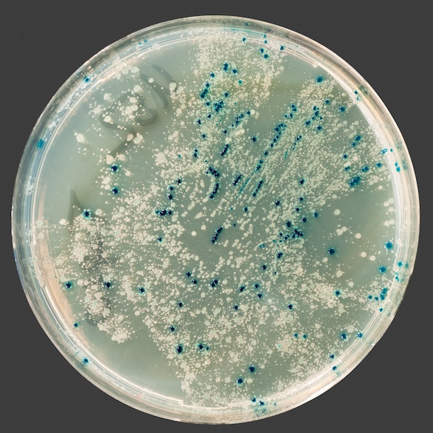 Bacterial colonies on agar plate