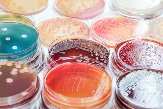 Bacterial culture growth on selective media; Micro bacteria Laboratory.