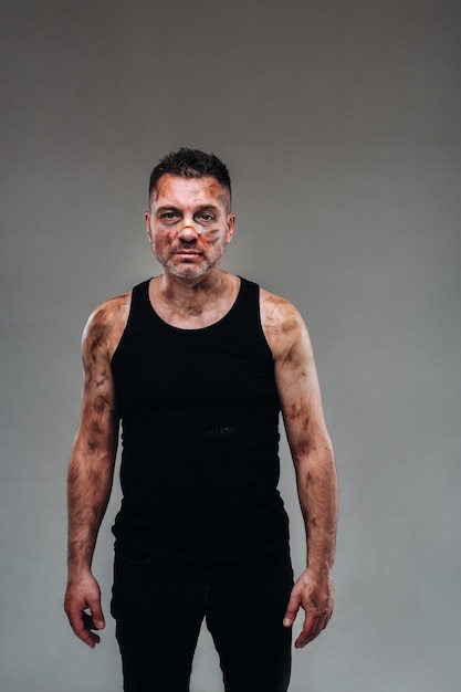 A battered man in a black T shirt who looks like a drug addict and a drunk stands against a gray background