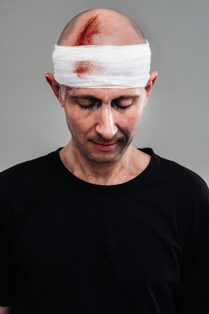 Photo battered man in a black t-shirt with his head wrapped in a bandage.