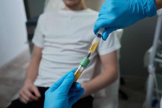 Beautician doctors hands put test tube with blood in centrifuge container rejuvenation plasmolifting