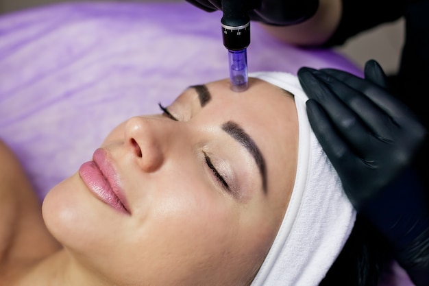 Beautician makes injections into the forehead of mesotherapy with a microneedle method.