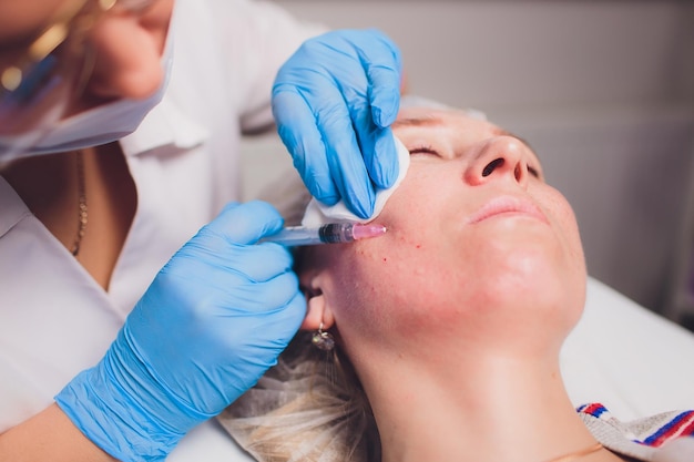 Beautician making injection in woman's face closeup Biorevitalization procedure