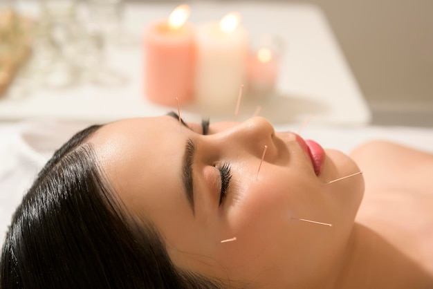 Beautiful Woman Received acupuncture treatment on face by therapist chinese medicine