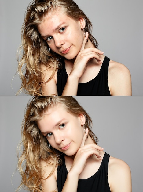 Before and after cosmetic operation. Young pretty woman portrait, isolated on a white background. Before and after cosmetic or plastic procedure, anti-age therapy