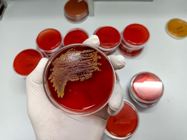 Biochemist of Lab Technologist holds Bacteria culture growth on Selective media plate