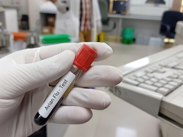 Biochemist or Lab Technologist holds Blood sample for Avian Flu test. Medical testing concept.