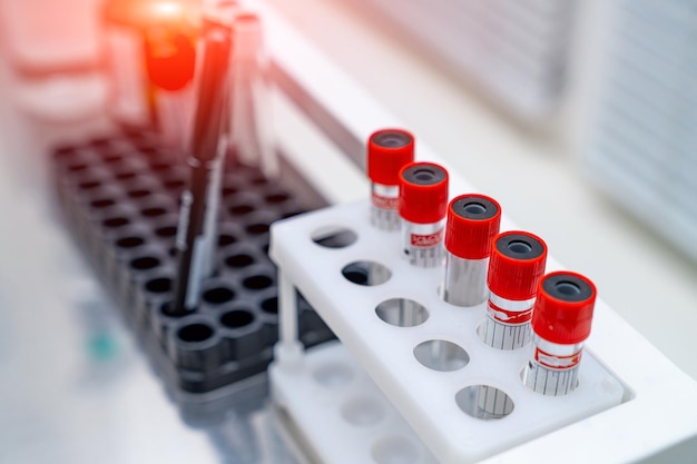 Biochemistry analyzing ward Hospital laboratory for analysing blood samples