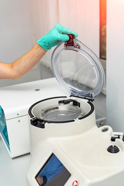 Biochemistry technologies in modern laboratory Plasma blood sample preparation in centrifuge