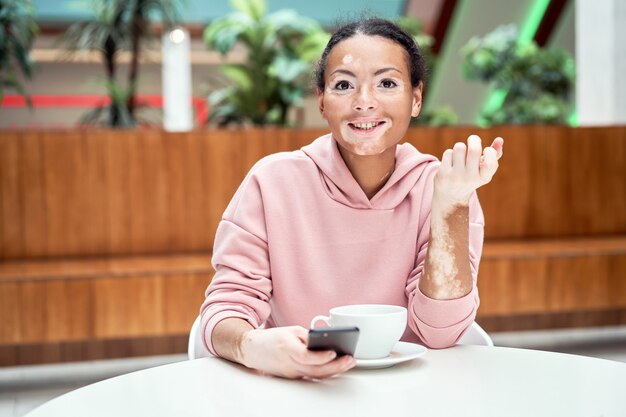 Black african american woman with vitiligo pigmentation skin problem indoor dressed pink hoodie sitting table using smartphone