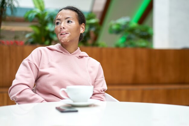 Black african american woman with vitiligo pigmentation skin problem indoor dressed pink hoodie