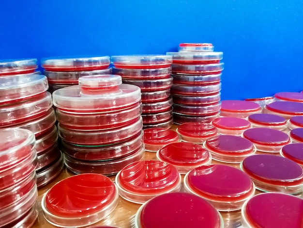 Blood agar medium on petri dish, Microbiology laboratory. Antimicrobial culture testing.