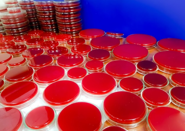 Blood agar medium on petri dish, Microbiology laboratory. Antimicrobial culture testing.