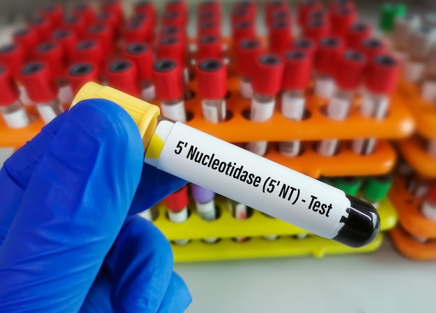 Blood sample for  5'-nucleotidase (5'-NT) test, investigate the origin of increased serum ALP