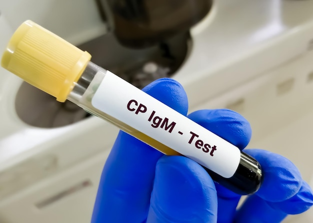 Blood sample for Chlamydia pneumoniae IgM or CP IgM test