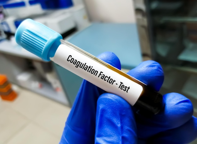 Blood sample for coagulation factor testing