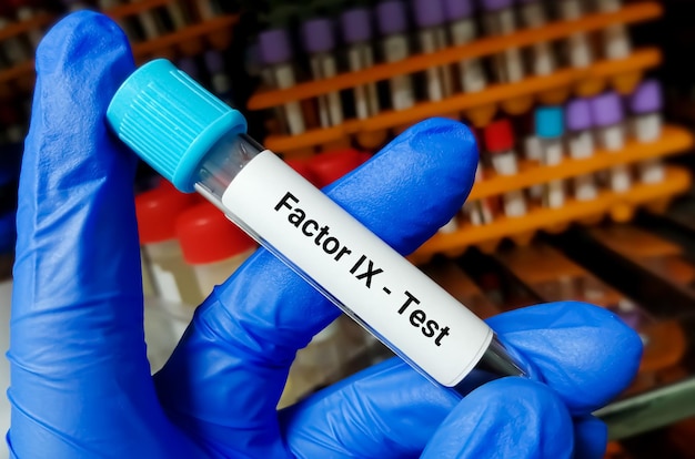 Blood Sample for Factor IX. Blood coagulation testing. Medical or health concept.