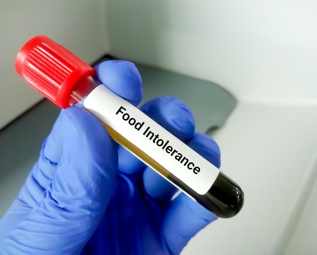 Blood sample for Food Intolerance test