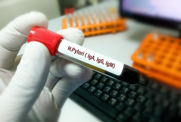 Blood sample for H Pylori test including IgA IgG and IgM